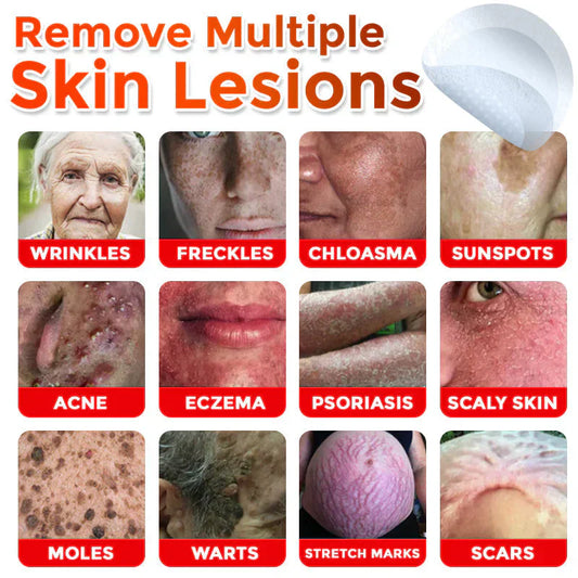GFOUK® MicroNeedle Botanic Skin Tag Removal Patch